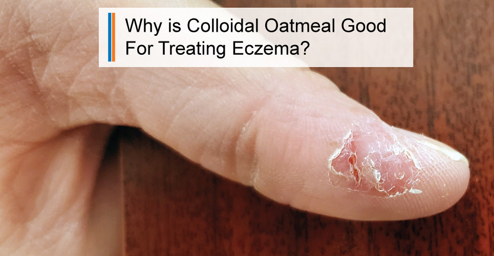 Why is Colloidal Oatmeal Good For Treating Eczema?