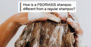 How Are Psoriasis Shampoos Different From Regular Shampoos?