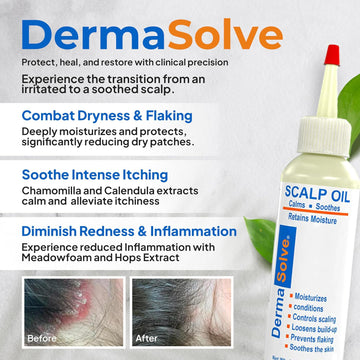 Dermasolve Scalp Oil