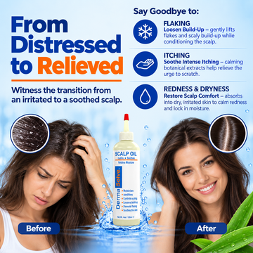 Dermasolve Scalp Oil