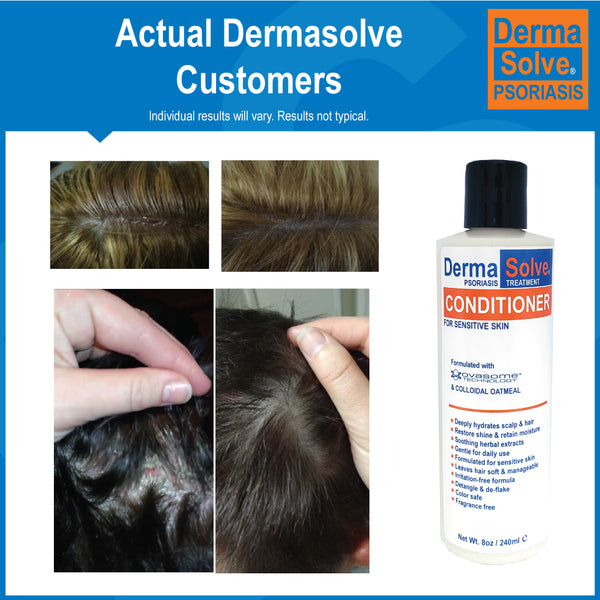 Dermasolve Psoriasis Shampoo & Conditioner Combo