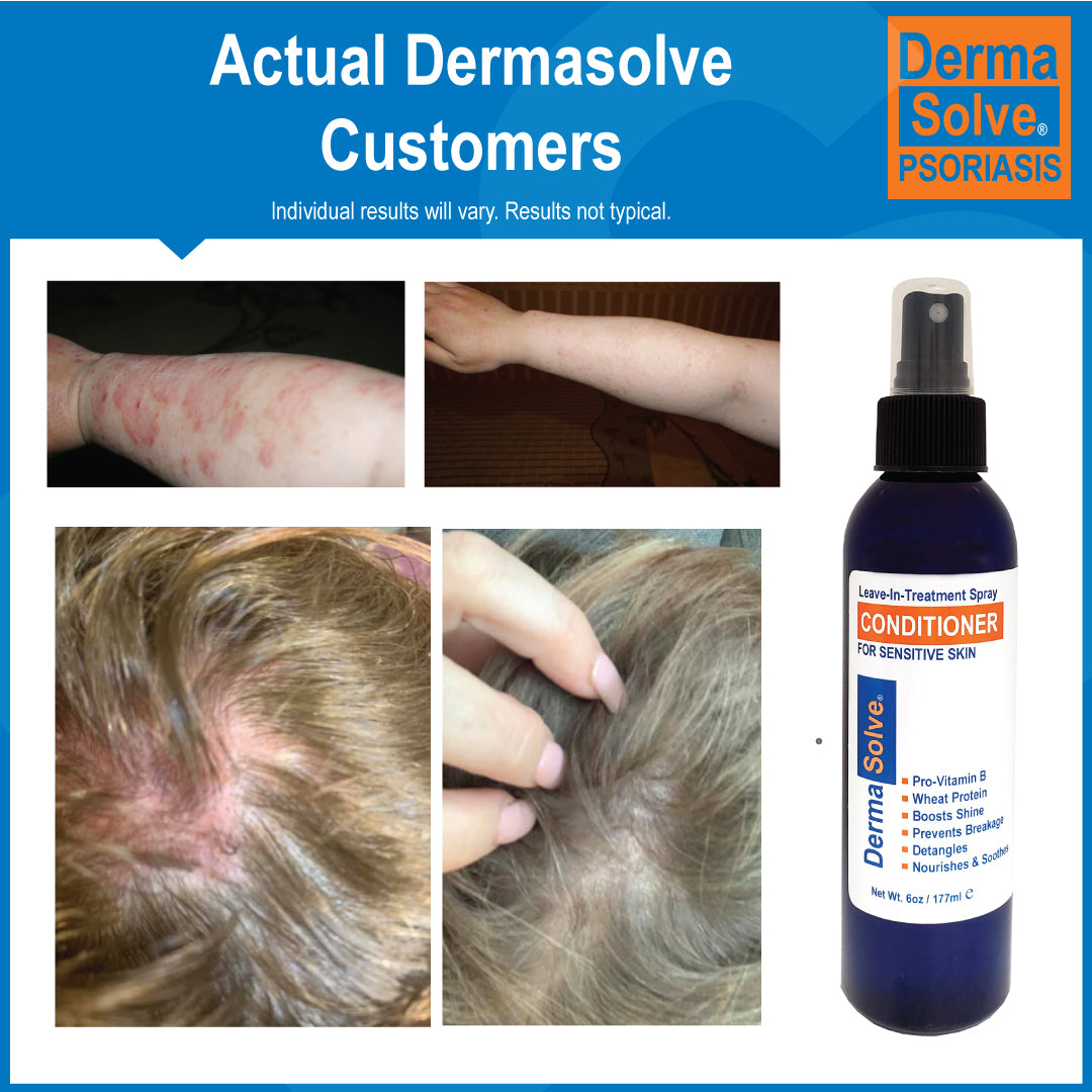Dermasolve Leave-In Detangler Spray Conditioner