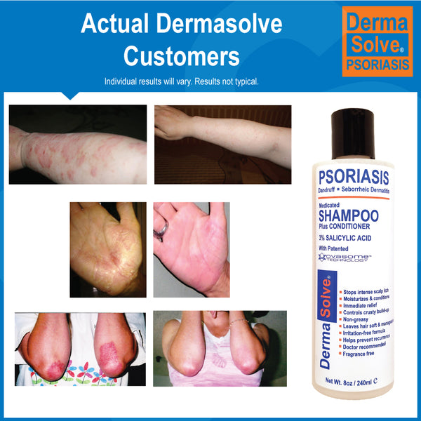 Dermasolve Psoriasis Shampoo 2-Pack