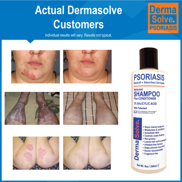 Dermasolve Psoriasis Shampoo 2-Pack